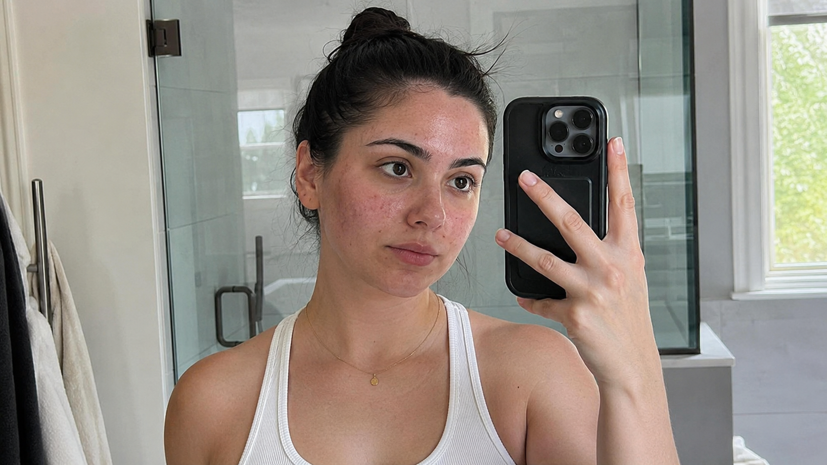 Skin before using Bioactive Prebiotics Jelly Serum